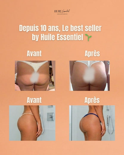 Suppositoire Volume Fesses